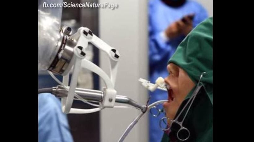 Κίνα: Ρομπότ έκανε μόνο του εμφύτευση δοντιών σε ασθενή (βίντεο)